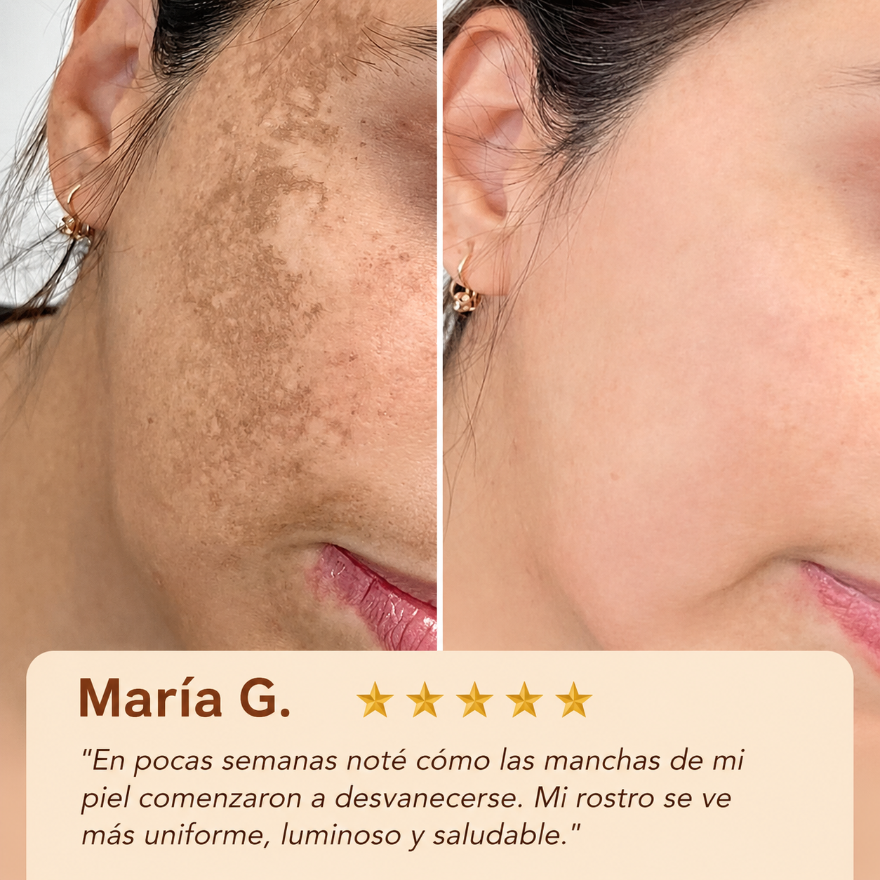 Solyva™ BubbleLift Collagen Mask
