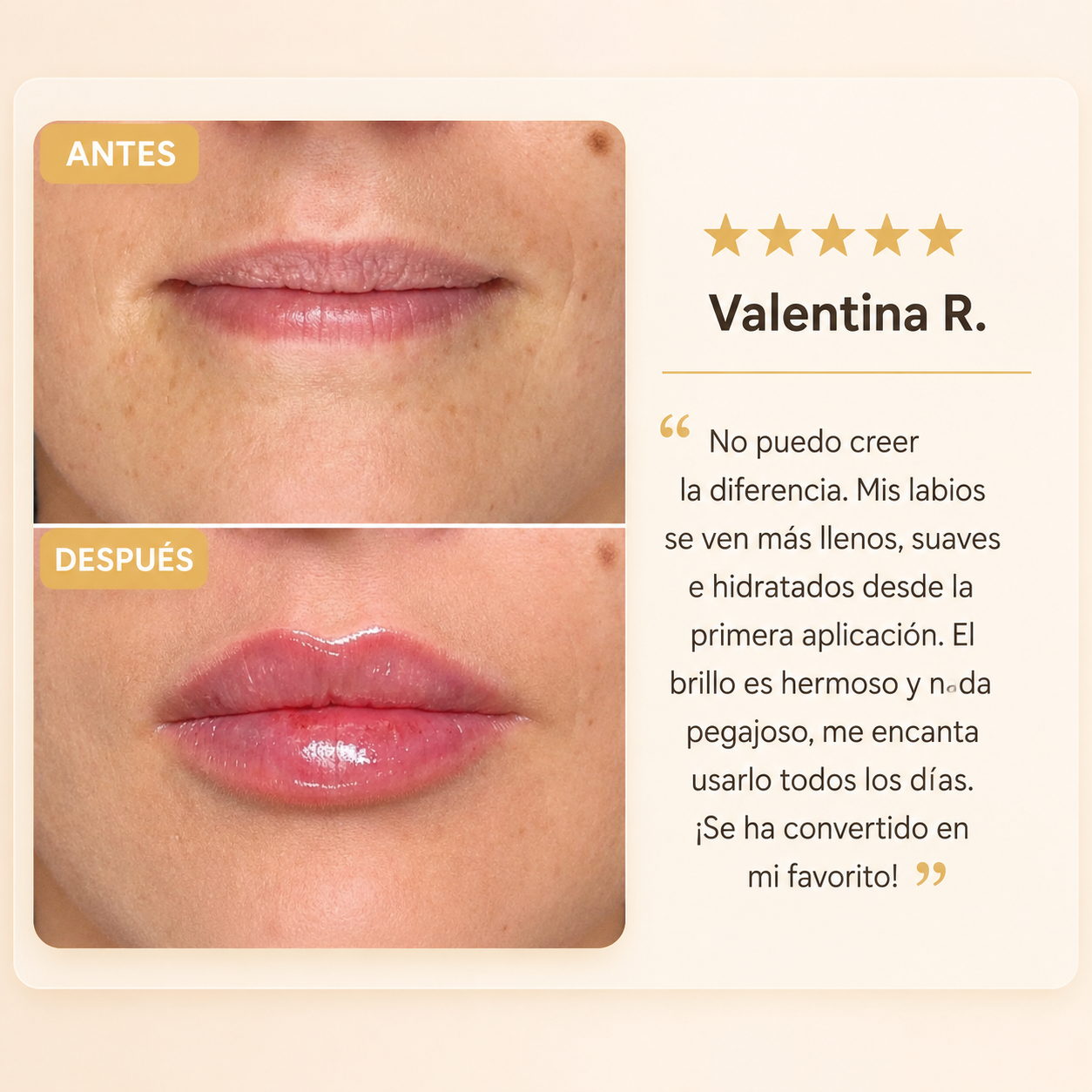 Solyva™ Volume Lip Elixir