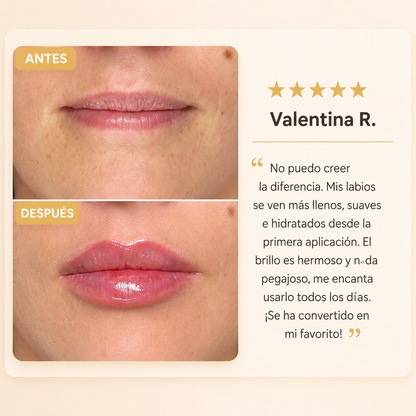 Solyva™ Volume Lip Elixir
