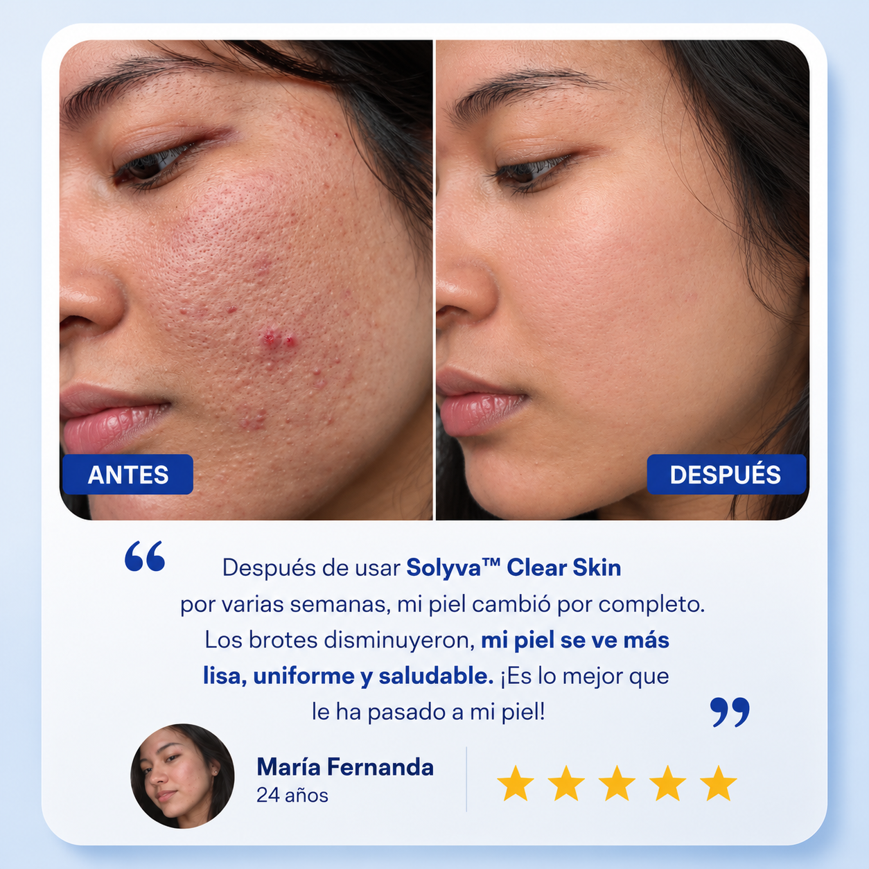 Solyva™ Clear Skin
