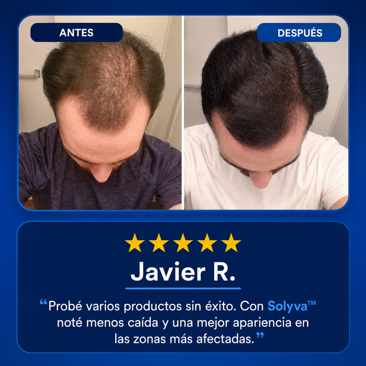 Solyva™ Density Revival Serum