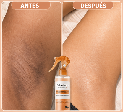 Solyva™ Peel Corporal Coreano